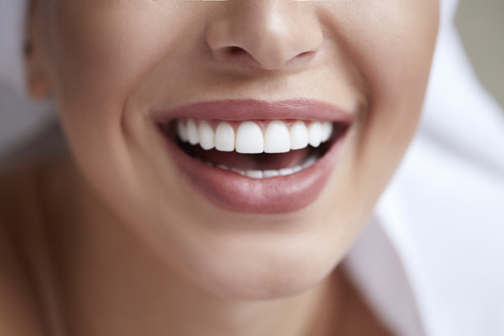 Veneers: What You Should Know About This Age-Defying Treatment