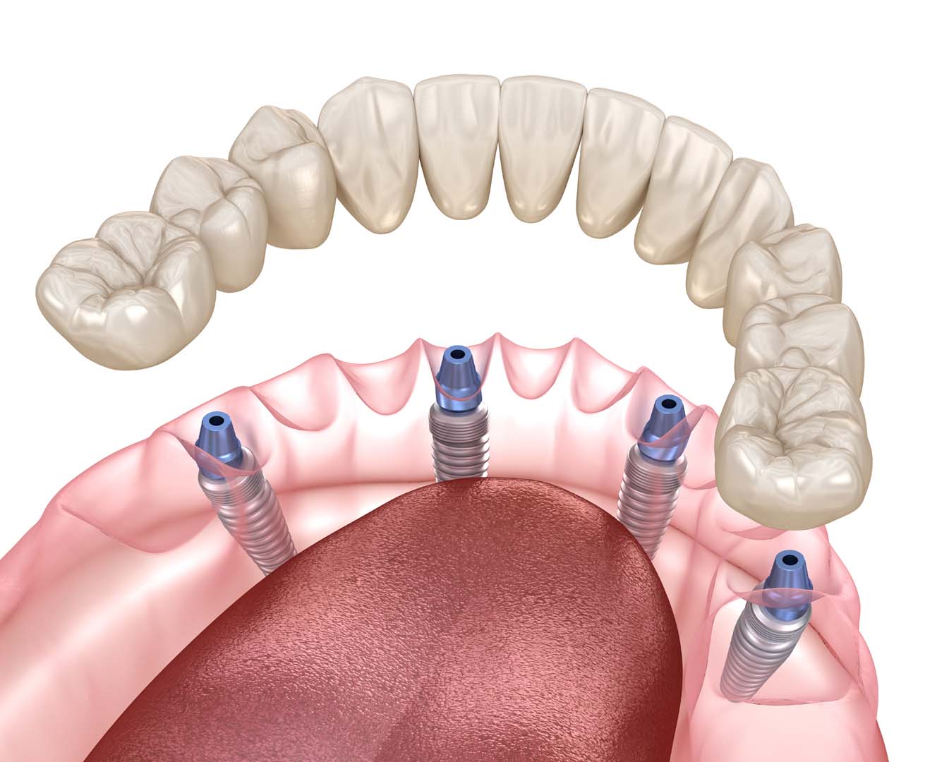 Why Pick Kidder Dental